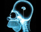 20100421232034_13194230_20100421231931_199930431_home-simpson-brain.jpg